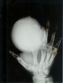 Case 3, Figure 1