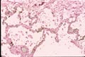 Case 4, Figure 3