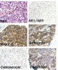 Case 12, Figure 1