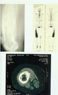 Case 16, Figure 1