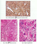 Case 18, Figure 1-3