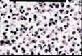 Case 2, Figure 1