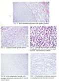 Case 21, Figure 1-5