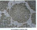 Case 2, Figure 1