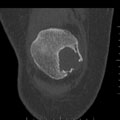 Case 16 - Spagnolo, Figure 5