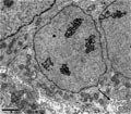 Case 10 - Masaharu Fukunaga, Figure 3