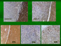Case 10 - Jernimo Forteza Vila, Figure 1