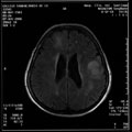 Case 10 - Jernimo Forteza Vila, Figure 1