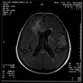 Case 10 - Jernimo Forteza Vila, Figure 2