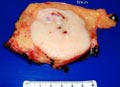 Quiz Case 1 - Saul Suster, Figure 1