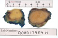 Case 17 - Dominic Spagnolo, Figure 1