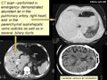 Case 5 - Michele Bisceglia, Figure 1