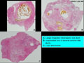 Case 5 - Michele Bisceglia, Figure 7