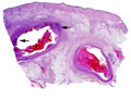 Case 10 - Cyril Fisher, Figure 2