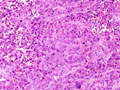 Case 10 - Cyril Fisher, Figure 4