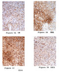 Case 12 - Andrew Folpe, Figure 1