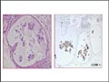 Case 11 - Forteza Vila, Figure 3