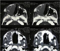 Case 21 - Zambrano, Figure 2