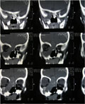 Case 21 - Zambrano, Figure 3