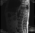 Case 15 - Forteza Vila, Figure 2