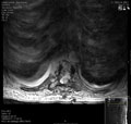 Case 15 - Forteza Vila, Figure 5