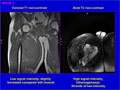 Case 18 - Spagnolo, Figure 1