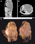 Case 4 - Berry, Figure 1