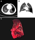 Case 5 - Berry, Figure 1