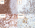 Case 9 - Fisher, Figure 2