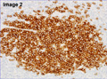 Case 17 - Spagnolo, Figure 2