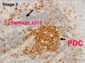 Case 17 - Spagnolo, Figure 3