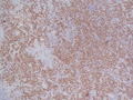 Case 3 - Ben Dor, Figure 1