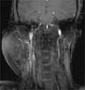 Case 19 - Perry, Figure 1