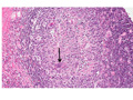 Case 19 - Perry, Figure 4