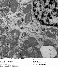 Case 8 - Malagon, Figure 5