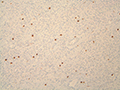 Case 13 - Rubin, Figure 1