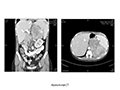 Case 7 - Forteza, Figure 1