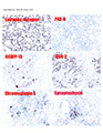 Case 9 - Gown, Figure 1